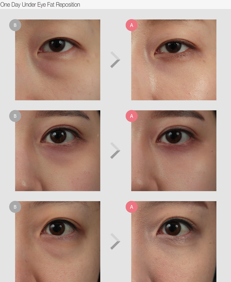 Before & After