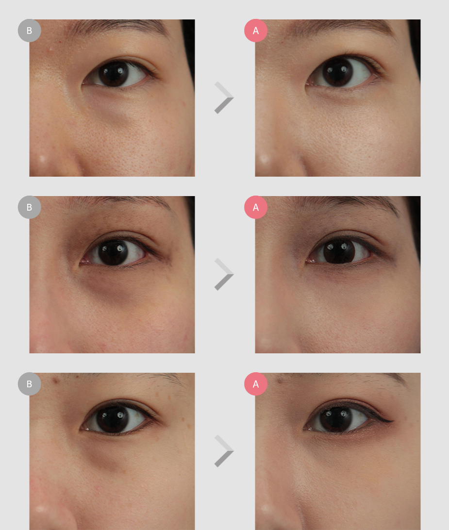 Before & After