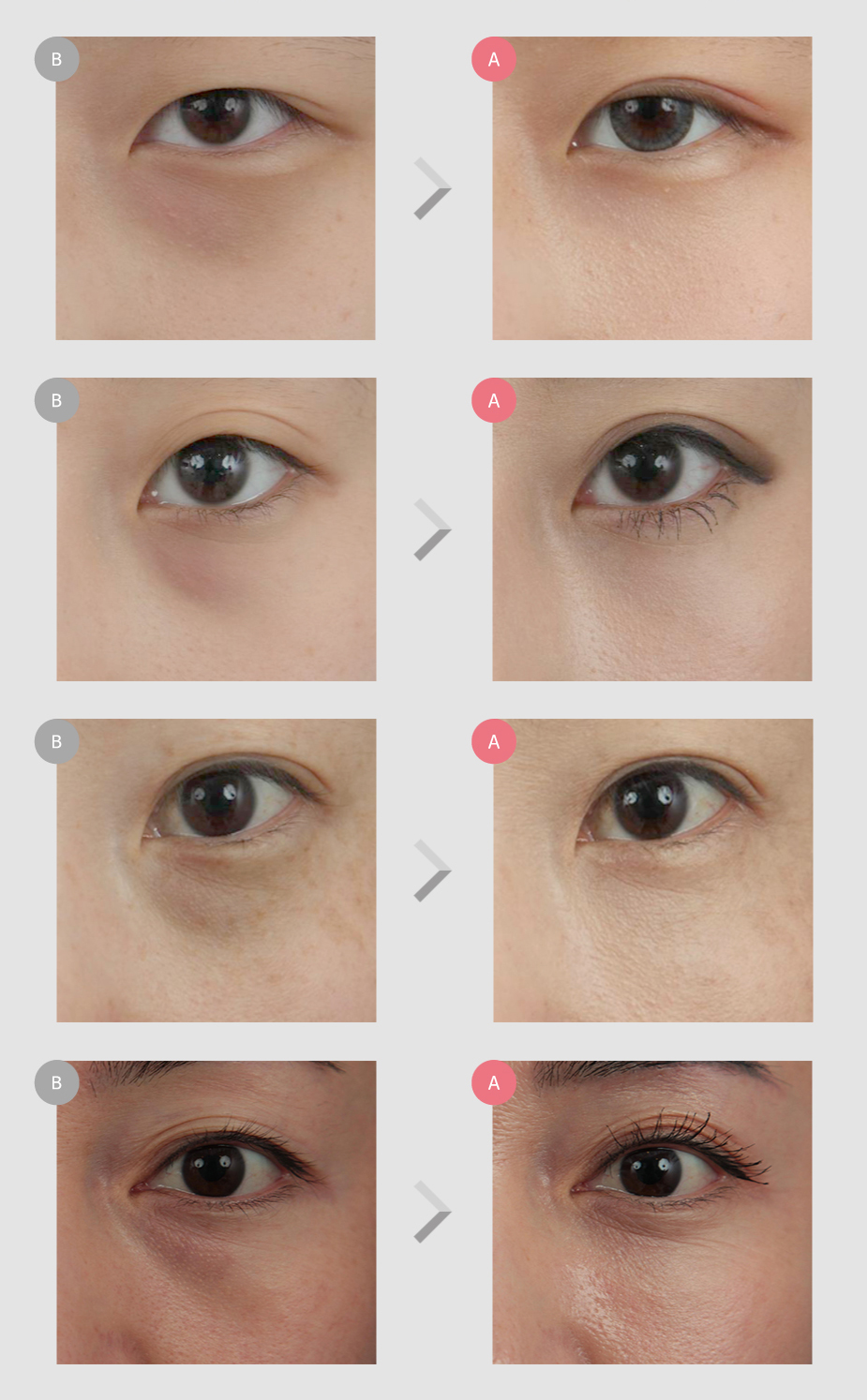 Before & After