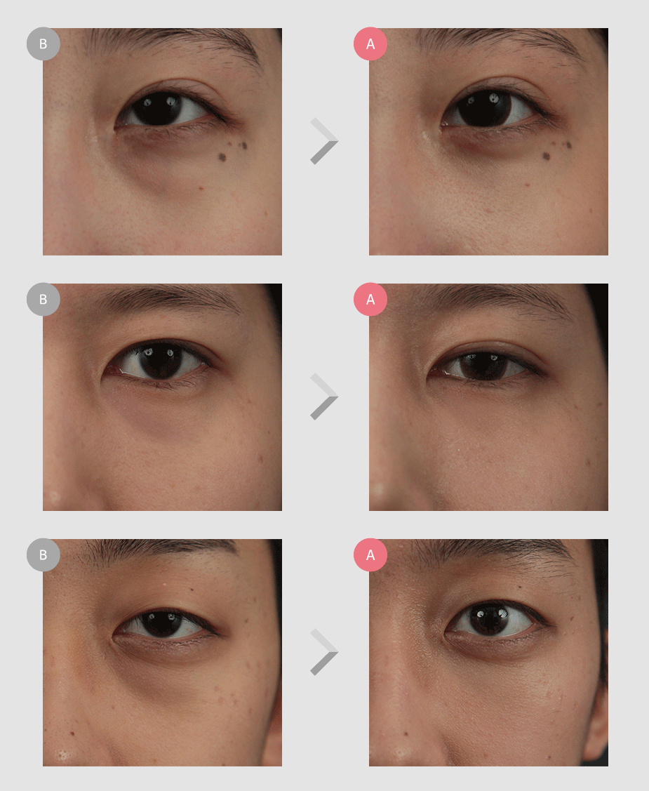 Before & After