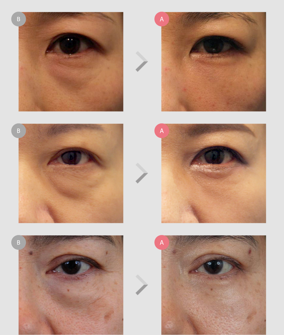 Before & After