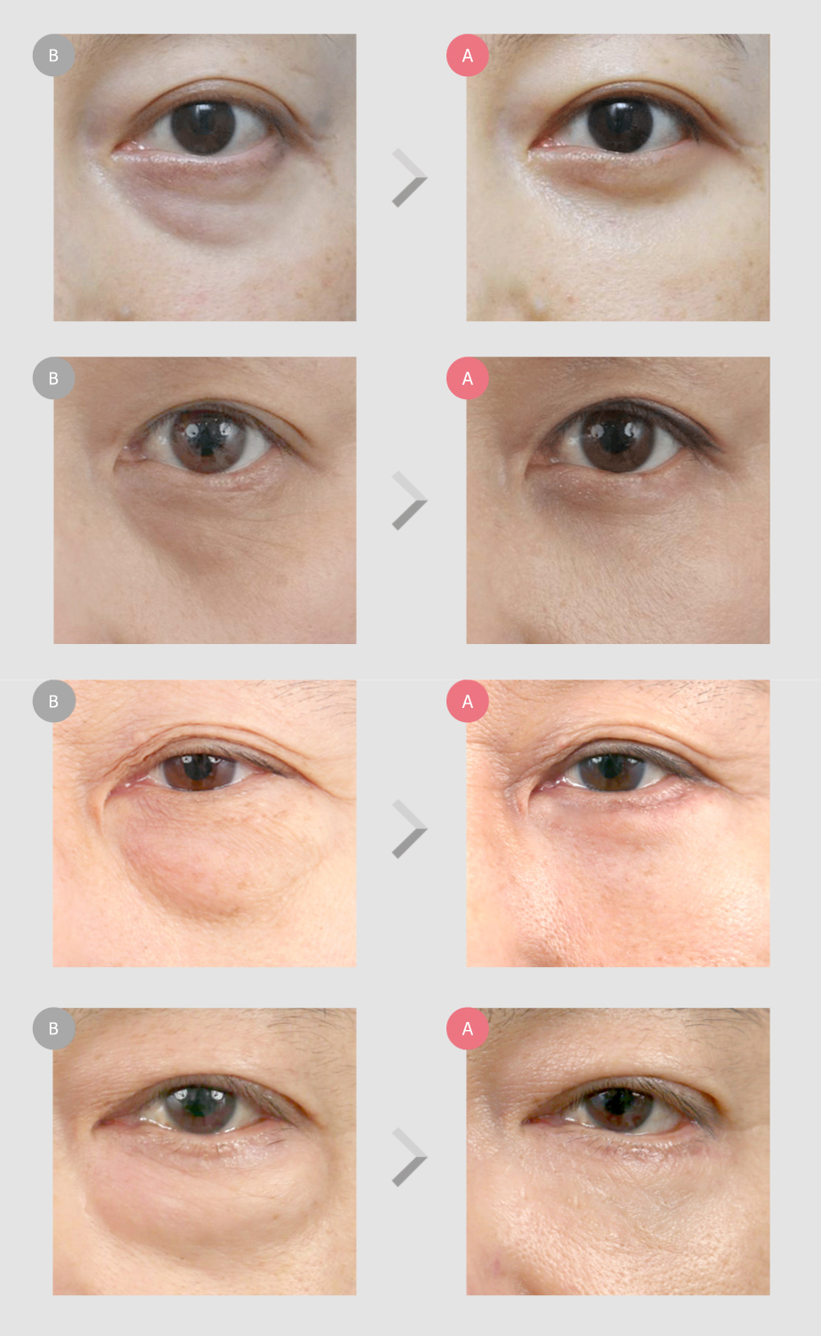Before & After