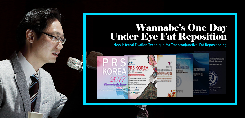 PRS GLOBAL OPEN, New Technique of internal Fixation in Transconjunctival Fat Repositioning-1