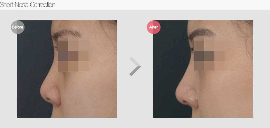 Before & After