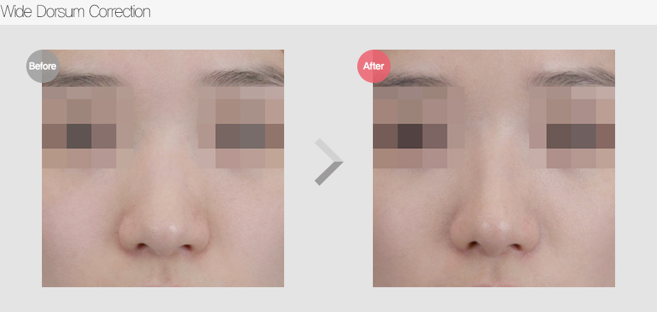 Before & After