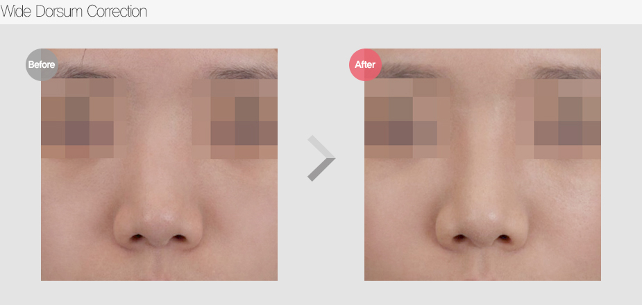Before & After