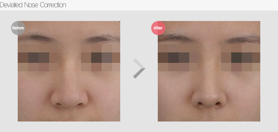 Before & After Pictures