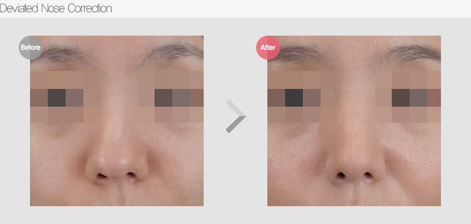 Before & After Pictures