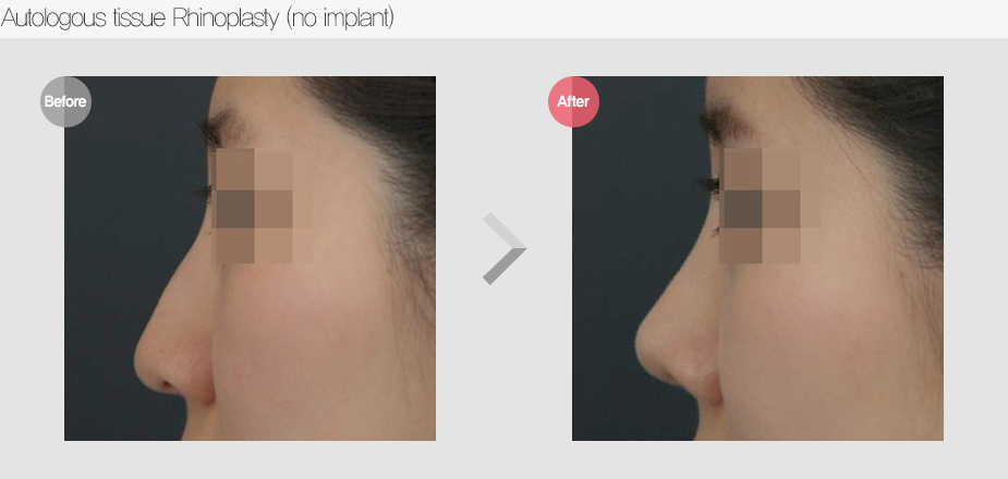 Before & After