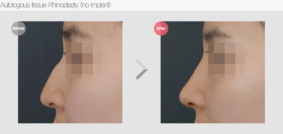 Before & After