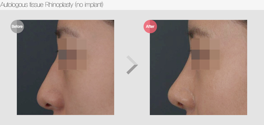 Before & After