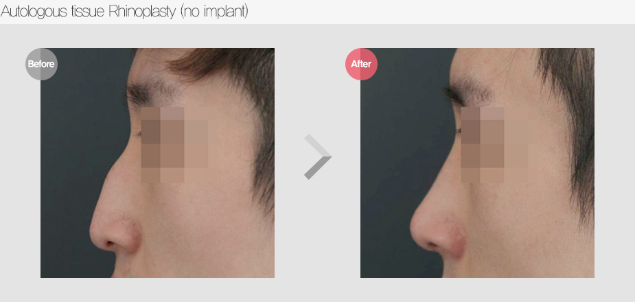 Before & After