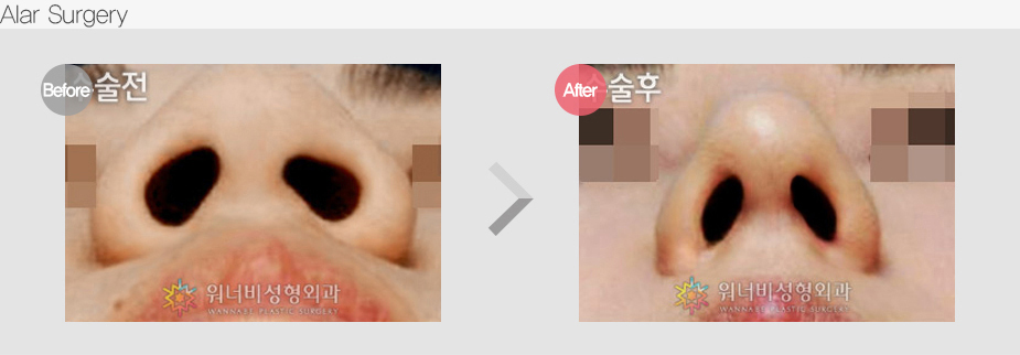 Before & After