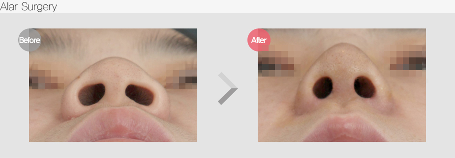 Before & After