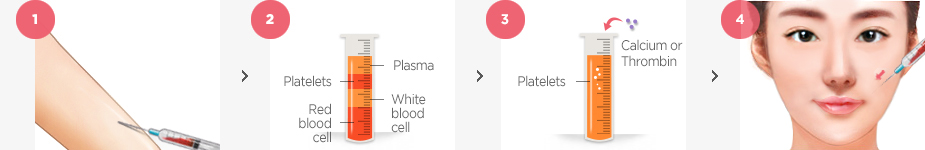 PRP Skin Rejuvenation Clinic Surgery method