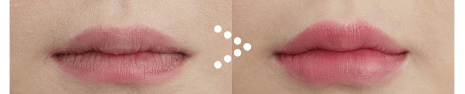 Before $ After