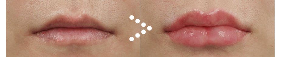 Before $ After