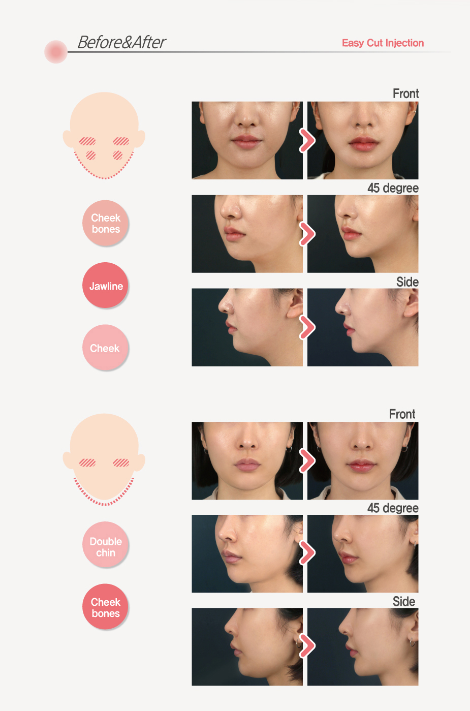 Before & After