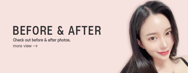 Before & After
    Check out before & after photos.